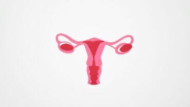 Uterus, ovaries, Endometriosis, endometrium