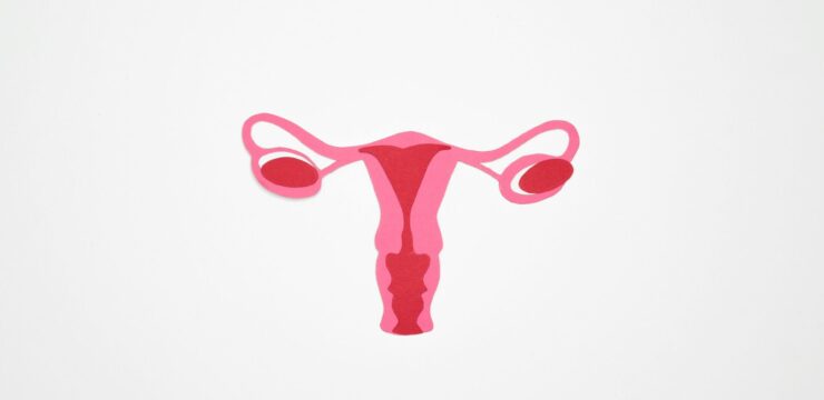 Uterus, ovaries, Endometriosis, endometrium